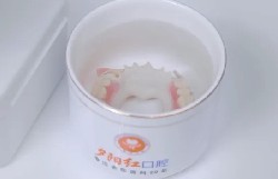 鑲牙后出現(xiàn)食物嵌塞、牙齒疼痛，別著急！教您科學(xué)應(yīng)對(duì)方法！