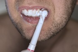 日常生活中需要注意哪些口腔護(hù)理問題