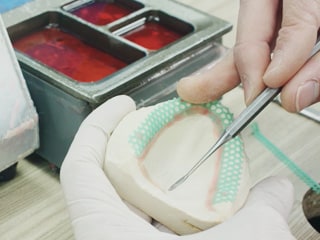 傳統(tǒng)支架蠟型基托