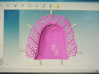 支架排版