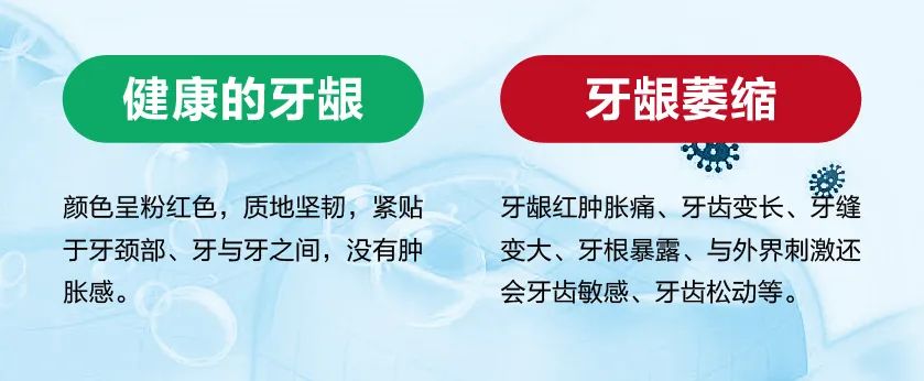 如何判斷自己是否有牙齦萎縮的癥狀呢？其實通過對比就能發(fā)現(xiàn)