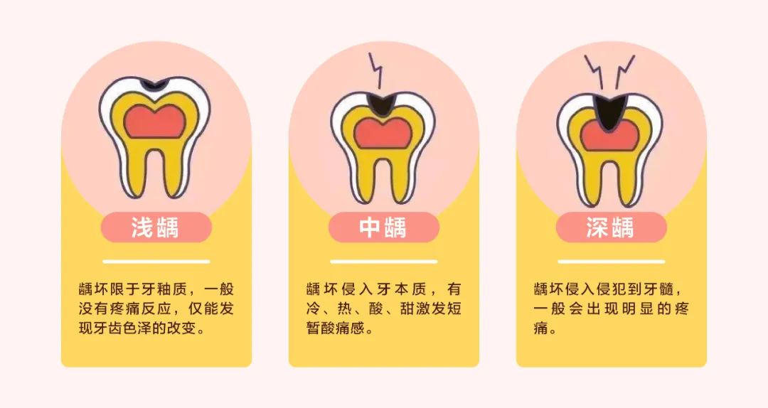 牙齒出現(xiàn)黑線，千萬(wàn)不要放任不管-2.jpeg