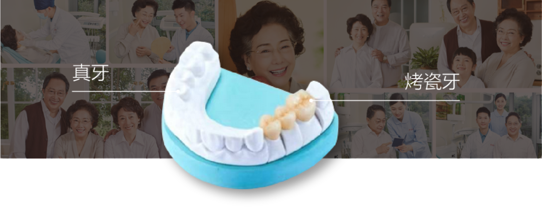 為什么牙齒缺失后要及時修復(fù)-7.png