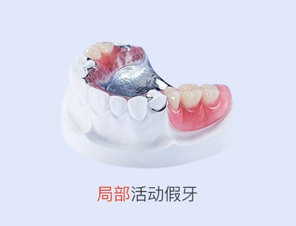 活動(dòng)假牙